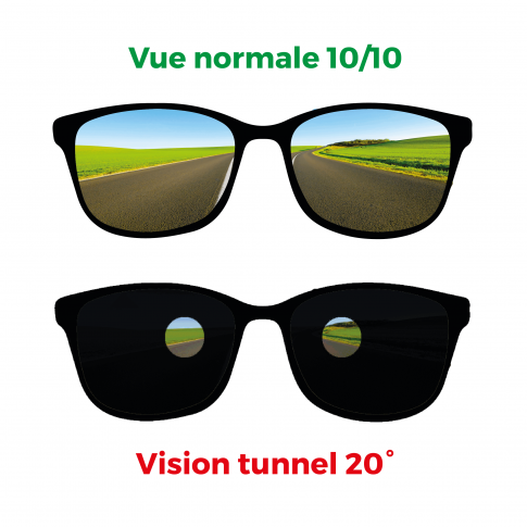 Lunettes simulant la vision tunnel 20°