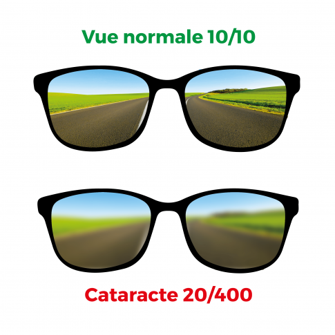 Lunettes simulant la cataracte