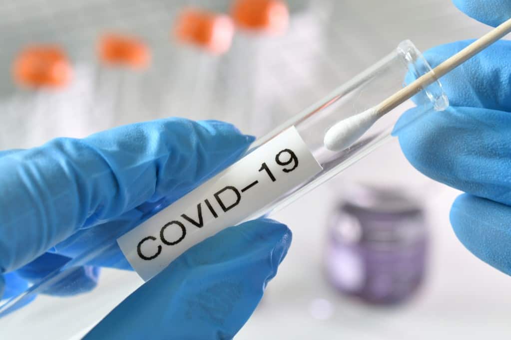 Différences tests covid : sérologique, antigénique, salivaire & PCR