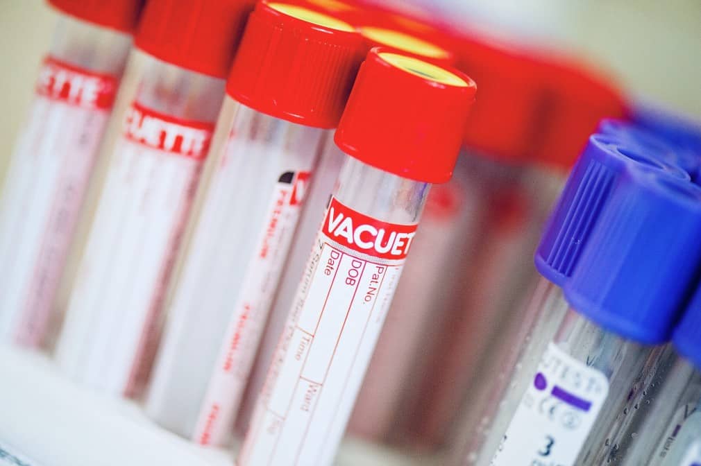 Différences tests covid : sérologique, antigénique, salivaire & PCR